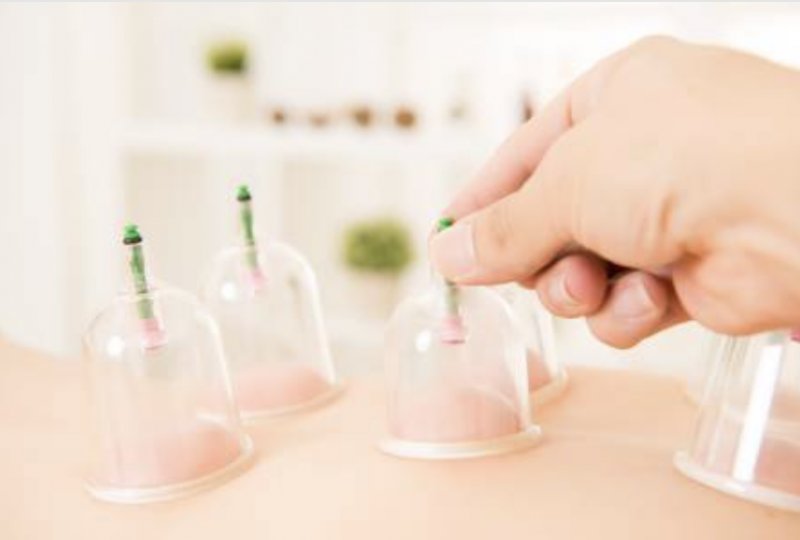 Hijama Und Blutegeltherapie Kurs